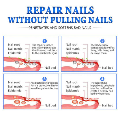 The Most Trusted Nail Fungus Solution 🌟 Clear, Strong & Healthy Nails Start Here-Powerful Ginger Nail Treatment