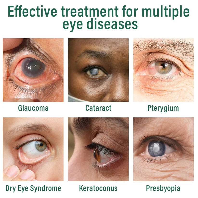 nexisify-nano-eye-drops-serum-fda-approved-suitable-for-presbyopia-dry-eye-syndrome-glaucoma-and-cataracts-5967