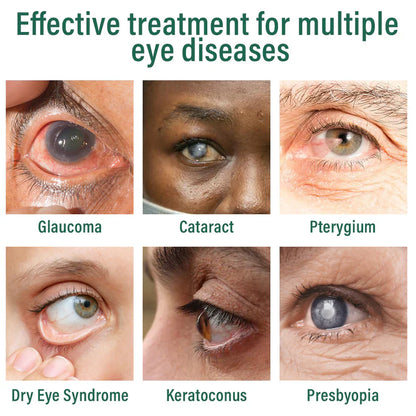 nexisify-nano-eye-drops-serum-fda-approved-suitable-for-presbyopia-dry-eye-syndrome-glaucoma-and-cataracts-5967