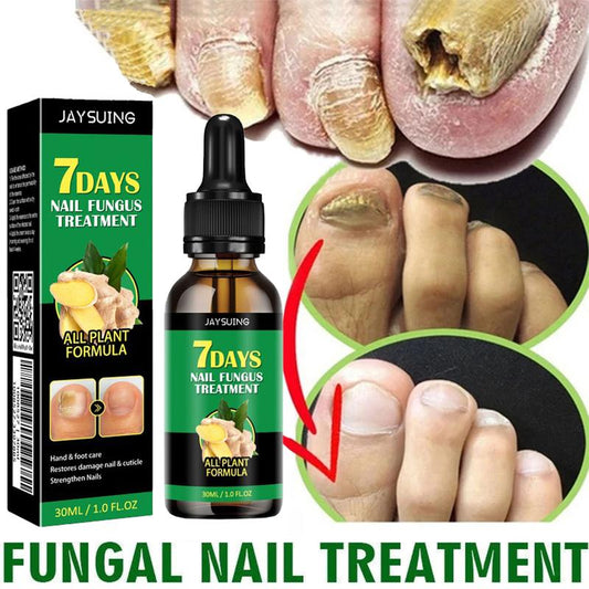 The Most Trusted Nail Fungus Solution 🌟 Clear, Strong & Healthy Nails Start Here-Powerful Ginger Nail Treatment