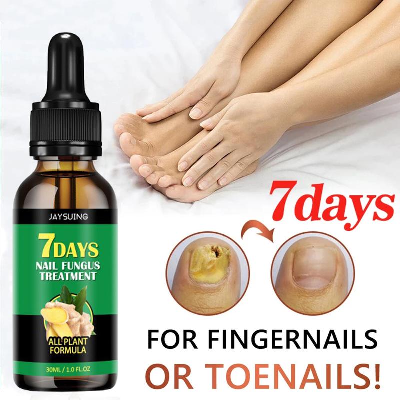 The Most Trusted Nail Fungus Solution 🌟 Clear, Strong & Healthy Nails Start Here-Powerful Ginger Nail Treatment