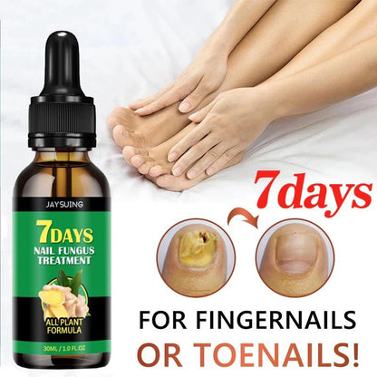 The Most Trusted Nail Fungus Solution 🌟 Clear, Strong & Healthy Nails Start Here-Powerful Ginger Nail Treatment